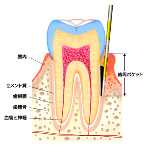 プローブ2.bmp
