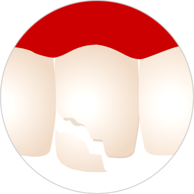 a.png