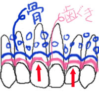 gumline adult.jpg